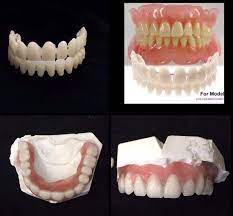 We are not yet scheduling patients for new dentures and partials or relines as we want to get through the repairs first. Diy Denture Kit Is Simple To Use Kit Comes With Full Upper Lower Acrylic Denture Teeth 28 On Wire Preformed In Sha False Teeth Affordable Dentures Denture