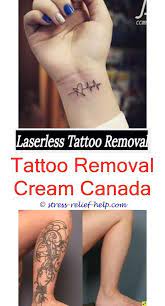 Tattoo Kits How Much Does Excision Tattoo Removal Cost Tattoo Removal Colorado Tattoo Removal Cream Can I Get A Tattoo Removed While Breastfeeding How Tattoos