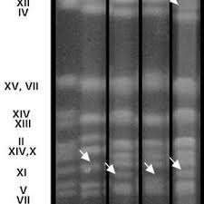 Siapkan wadah bersih kemudian letakan singkong rebus dan taburkan dengan ragi. Electrophoretic Karyotypes Of The Prevalent S Cerevisiae Strains In Download Scientific Diagram
