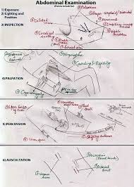 Image result for Shifting Dullness Test