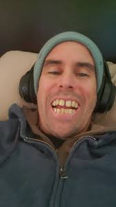 check out my teeth. #teeth #dental #invisilign #gordontarpley