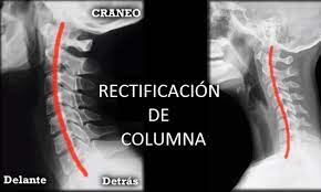 Las causas de los dolores cervicales pueden ser, entre otras: Venta Como Dormir Con Cervical Rectificada En Stock