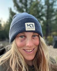 Don't ask about the other guy 🥊😉 Learning new things can be hard & scary.  Super glad my daddy-o flew down in a days notice cause I needed him around.  He taught