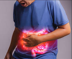 Image result for Flatulence