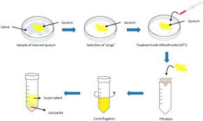 Image result for Sputum