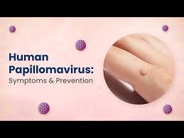 Image result for human papillomavirus symptoms