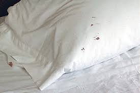 Alo hotel by ayres orange bed bugs. How To Check Your Bedroom For Bed Bugs Unbugme Pest Control Termite