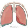 This is because in 2012, the uk government decided that mesothelioma is so . Https Encrypted Tbn0 Gstatic Com Images Q Tbn And9gcrbcu6lp7zwmyvcta39kqdiif3ptu0m3j3ijnwhyzavu5bu U G Usqp Cau