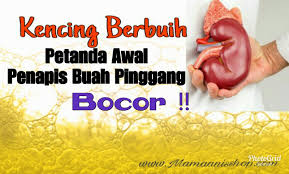 Jika air seni yang anda keluarkan tampak berbusa, ini bisa jadi terkadang, kencing berbusa pun bisa terjadi bila anda kurang minum atau sedang mengalami. Kencing Berbuih Petanda Awal Penapis Buah Pinggang Bocor