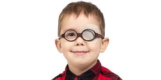How do you get a lazy eye. Amblyopia Lazy Eye Aoa