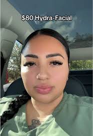 Alaina Mathers Hydrafacial