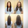 A stressful event or acute illness may cause a person to shed more hair than normal. 1
