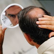 Obesity is having too much body fat, marked by a bmi of 30 or higher. Can Obesity Cause Hair Loss Ahs India