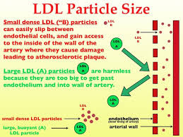 Why Your Ldl Cholesterol Particle Size Determines Your Heart