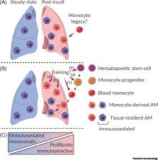 Primary lung cancer pulmonary langerhans cell histiocytosis klebsiella pneumoniae. Teaching Old Dogs New Tricks The Plasticity Of Lung Alveolar Macrophage Subsets Trends In Immunology
