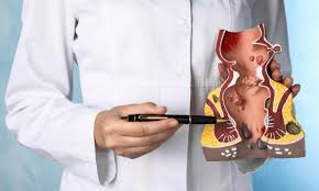 Image result for itchy skin rectum