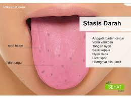 We did not find results for: Arti 7 Warna Lidah 2 Rumah Sehat Herba Holistic