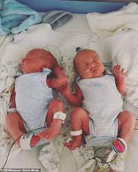 Who estimates that preterm birth was responsible for nearly 1 million deaths in 2015. Twins Defy The Odds Of Squashing Each Other To Death Due To Rare Condition Express Digest