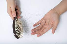 Rambut rontok adalah masalah rambut yang bisa terjadi pada siapa saja. 8 Indikator Parahnya Kerontokan Rambut Halaman All Kompas Com