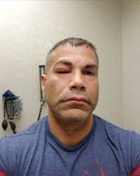 Surfboard impales man, leaving viewer disappointed