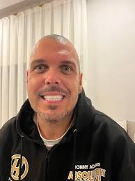 There we go guys the finished teeth 🦷 I am actually in love with them 🥰  Want yours doing get in touch with DentArma Turkey Dental Aesthetics and  Implantology Clinics Tell em