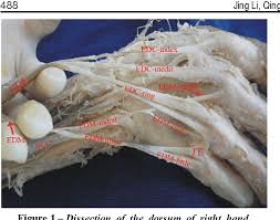 Originates from the lateral epicondyle of the humerus. Figure 1 From Accessory Slips Of The Extensor Digiti Minimi Semantic Scholar