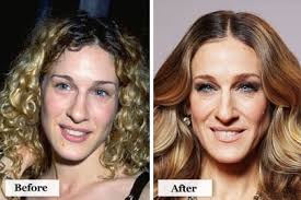 According to a new tabloid report, sarah jessica parker has received extensive plastic surgery on her hands. Sarah Jessica Parker Before They Were Famous Scary Celebrity Hairstyles Skin And More Page 3