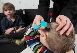 Lice Treatment Using Baking Soda