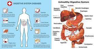 Disorders And Diseases Of The Digestive System Diseases Of The Mouth Salivary Glands Pharynx Oesophagus Stomach I Digestive Disease Gallbladder Bile Duct