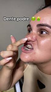 Dente Podre De Crianças Memes Pro Filho Acreditar