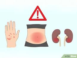 Comments from original poster (4) comments from original poster (4). 4 Ways To Take Miralax Wikihow