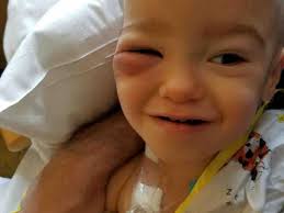 Fundraiser by Lola Comfi : Help Us Help Andrew Fight LCH