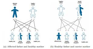 Effects Of Selection And Mutation On Epidemiology Of X Linked Genetic Diseases