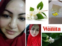 Di antara penawar resdung adalah: Sapu Air Perahan Limau Tepek Hirisan Daun Pandan Di Muka Petua Tradisional Untuk Sakit Resdung Kronik Mingguan Wanita