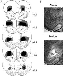 Maybe you would like to learn more about one of these? Dissociable Roles For The Basolateral Amygdala And Orbitofrontal Cortex In Decision Making Under Risk Of Punishment Journal Of Neuroscience