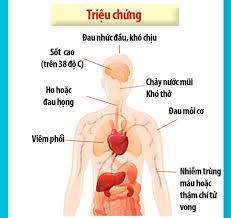 Việc nhiều quốc gia trên thế giới liên tục phát hiện phát hiện ca nhiễm biến chủng của vi rút corona có nguồn gốc từ anh đang làm tăng lo ngại nỗ lực. Triá»‡u Chá»©ng Cá»§a Bá»‡nh Viem Ä'Æ°á»ng Ho Háº¥p Cáº¥p Do Chá»§ng Má»›i Cá»§a Virus Corona Ncov
