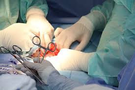 Nerve-Sparing Pelvic Surgery