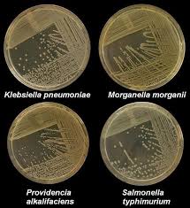 Nutrient Agar Composition Preparation And Uses