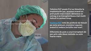 La prietenul asta care are implant de o luna a durat operatia 7 ore. Cat Costa Un Implant De Par In Bucuresti Youtube