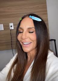 Ivete Sangalo fala de recuperação ao retomar agenda de trabalho: 'Ainda sinto um pouco de dormência'