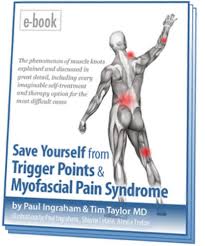 The Complete Guide To Trigger Points Myofascial Pain 2019