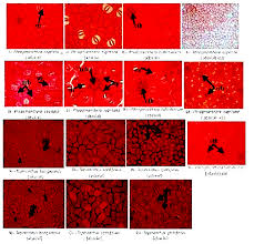 Image result for Agelanthus krausei