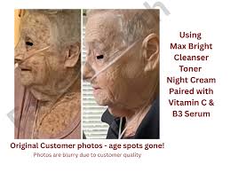 Max Bright Vitamin C Toner