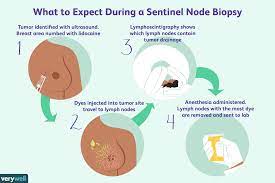 Louis has been recognized once again as a top u.s. Lymph Node Positive Breast Cancer Symptoms And Treatment