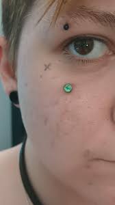 Why does my nose piercing smell like cheese