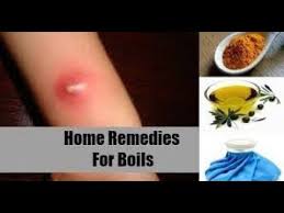We did not find results for: How To Get Rid Of Boils On The Buttocks Boil Home Remedy Boil Treatment Home Remedies Youtube