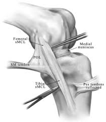 Check spelling or type a new query. Ligaments Of The Knee Recon Orthobullets