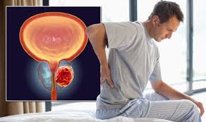 The prostate is a gland in the male reproductive system that surrounds the urethra just below the bladder. Cancer Symptoms Clinical Oncologist Warns Of Unusual Signs Of A Growing Prostate Tumour Express Co Uk