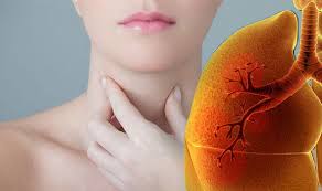 Some people just have general symptoms of not feeling well. Lung Cancer Symptoms If Your Voice Sounds Like This It Could Signal The Deadly Disease Express Co Uk
