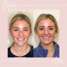 Laura Frances's Instagram, Twitter & Facebook